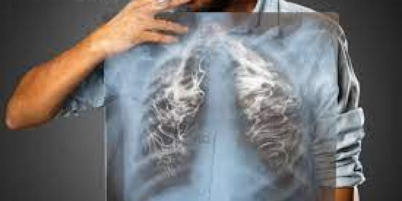 Tips Membersihkan Paru-Paru Dari Asap Rokok