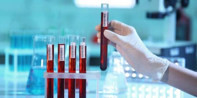 GAMBARAN HASIL KADAR ENZIM SGOT DAN SGPT PADA PASIEN TUBERKULOSIS AWAL DI RUMAH SAKIT PARU KARANG TEMBOK SURABAYA
